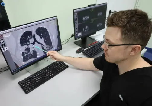 В ХМАО хирурги удалили из легкого пациента позвонок птицы