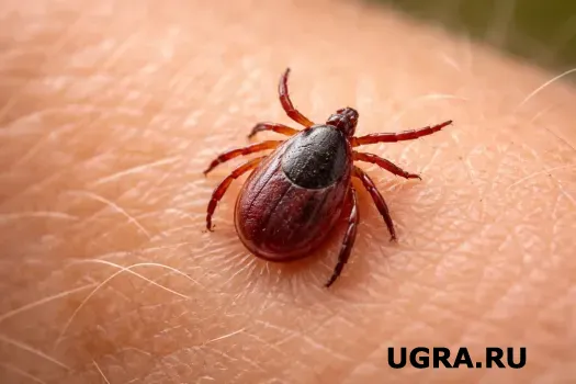 В Югре увеличилась заболеваемость клещевым энцефалитом